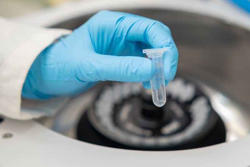 Low-Speed Refrigerated Centrifuge